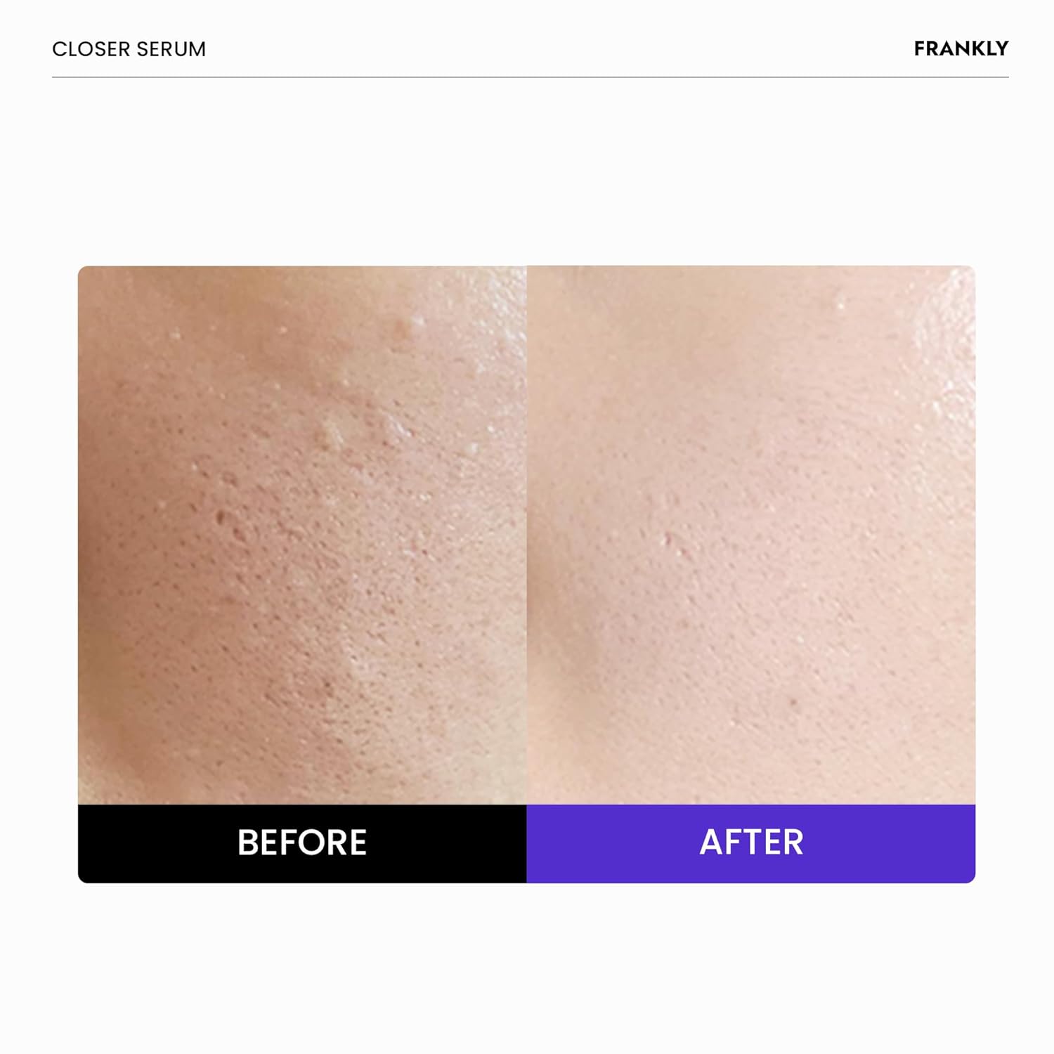 [ FRANKLY ] Closer Pore Reducing Serum 30ml / 1 fl.oz